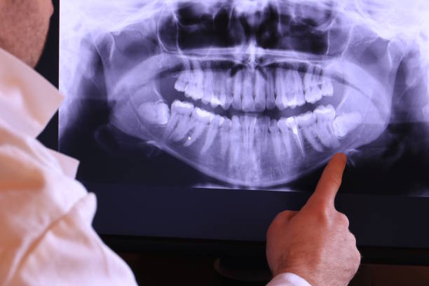 Best Emergency Root Canal Therapy in Murphysboro, IL